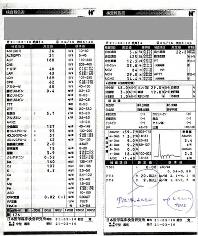 甲状腺ホルモンの血液検査結果